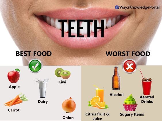 Causes of Tooth Decay