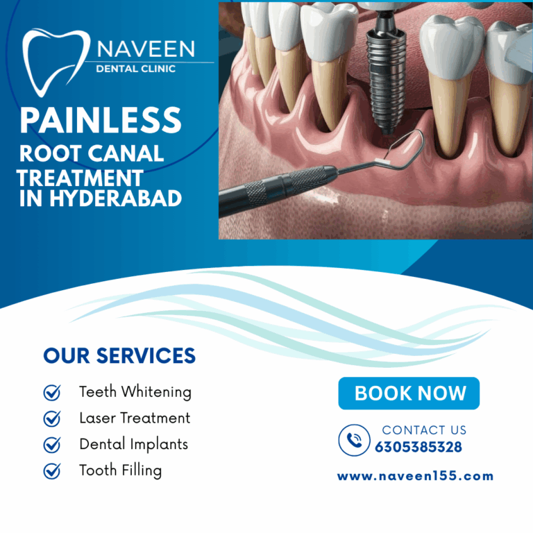 Painless root canal treatment in Hyderabad