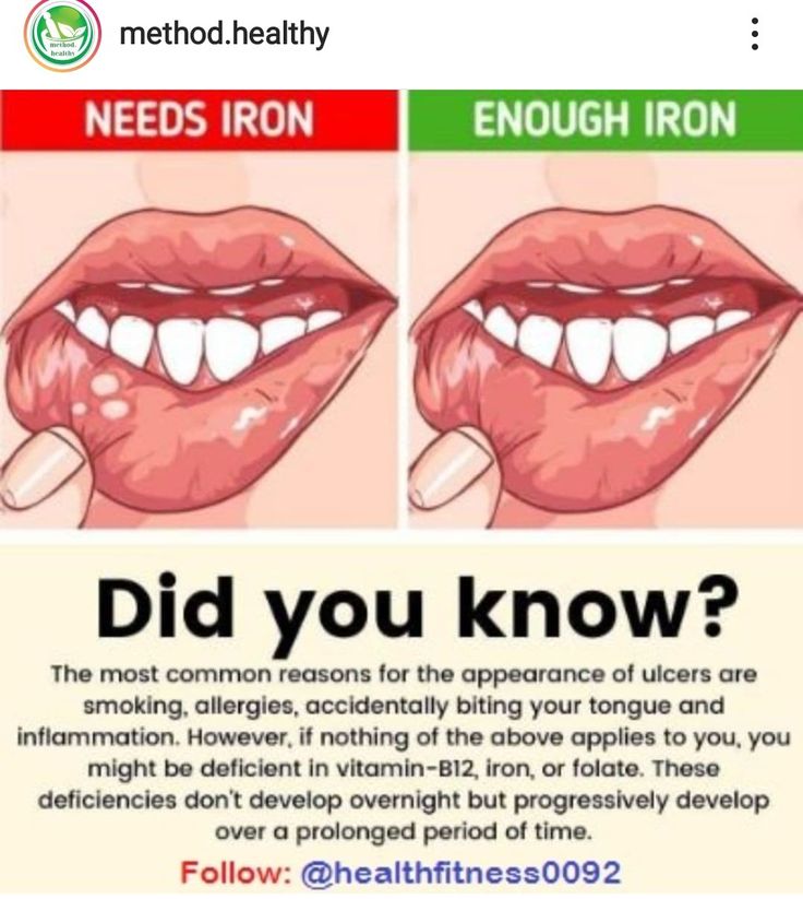 Effective Toothache Relief at Home